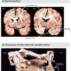 医療関係者必見！書籍「正常画像と比べてわかる病理アトラス」(羊土社)の電子版アプリが優秀！のサムネイル